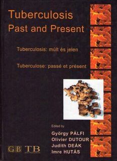 Tuberculosis: múlt és jelen - Tuberculosis: Past and Present